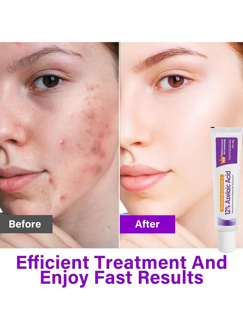 12%Azelaic Acid Serum, Lighten Acne Marks,Relieves Redness, Dark Spots, Rosacea, Balances Excess Sebum, Brightening Face Skin Care Treatment for All Skin Types 20g