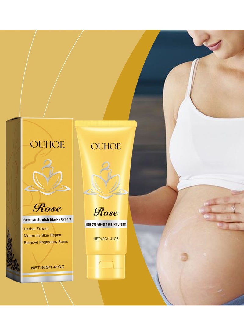 Rose Stretch Marks Removal Cream, Scar Reduction & Deep Stretch Mark Treatment, Hydrating Skin Repair Cream for Pregnancy, Increases Elasticity 40g