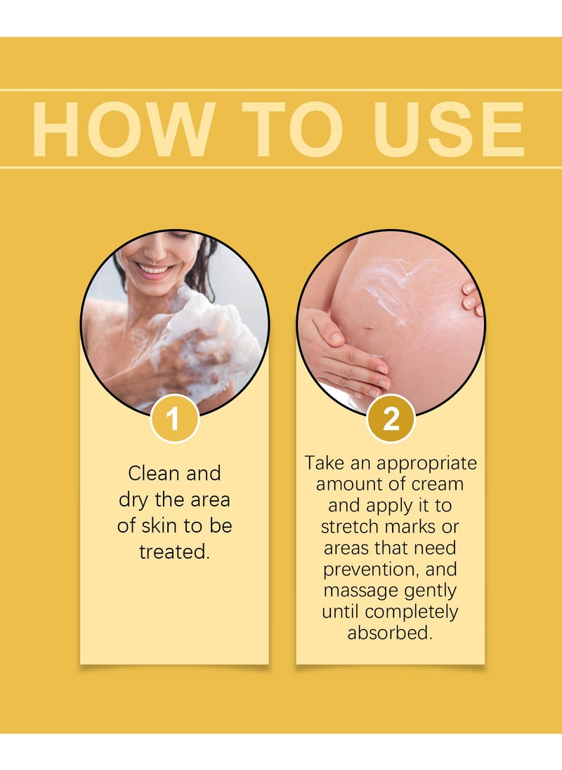 2-PACKS Rose Stretch Marks Removal Cream, Scar Reduction & Deep Stretch Mark Treatment, Hydrating Skin Repair Cream for Pregnancy, Increases Elasticity 40g*2