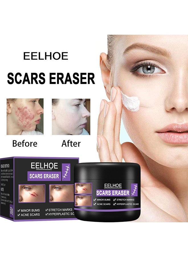 Scars Eraser - Scar Removal Gel, Scar Removal Cream, Acne Scar Treatment，Deep Acne Scar Removal, Burns Keloids Hypertrophic, Repair Damaged Skin, Removing Acne Marks Scar Repair Cream 50g﻿