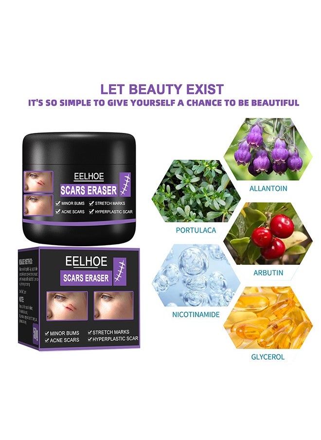 Scars Eraser - Scar Removal Gel, Scar Removal Cream, Acne Scar Treatment，Deep Acne Scar Removal, Burns Keloids Hypertrophic, Repair Damaged Skin, Removing Acne Marks Scar Repair Cream 50g﻿