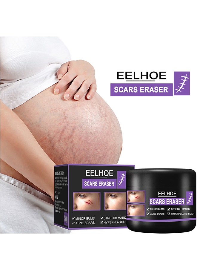 Scars Eraser - Scar Removal Gel, Scar Removal Cream, Acne Scar Treatment，Deep Acne Scar Removal, Burns Keloids Hypertrophic, Repair Damaged Skin, Removing Acne Marks Scar Repair Cream 50g﻿