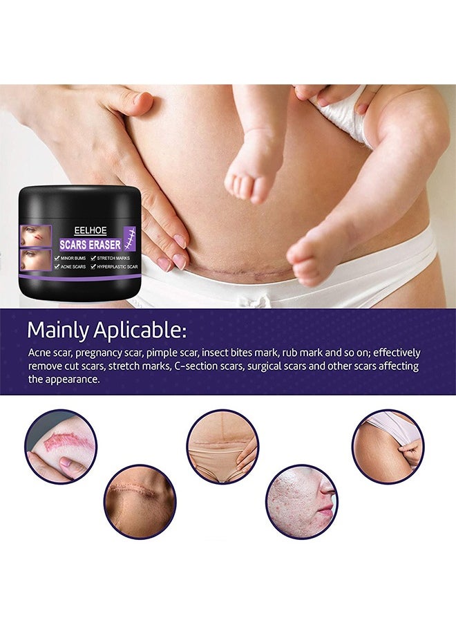 Scars Eraser - Scar Removal Gel, Scar Removal Cream, Acne Scar Treatment，Deep Acne Scar Removal, Burns Keloids Hypertrophic, Repair Damaged Skin, Removing Acne Marks Scar Repair Cream 50g﻿