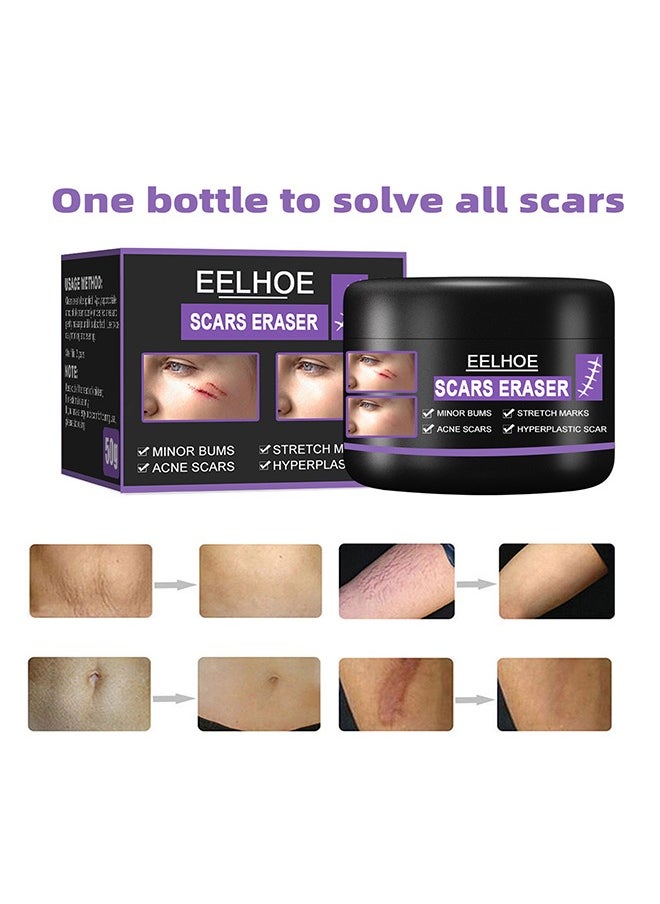 Scars Eraser - Scar Removal Gel, Scar Removal Cream, Acne Scar Treatment，Deep Acne Scar Removal, Burns Keloids Hypertrophic, Repair Damaged Skin, Removing Acne Marks Scar Repair Cream 50g﻿