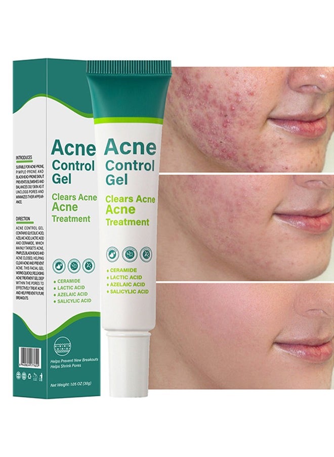 Acne Control Gel, Clears Acne, Acne Treatment Cream,Acne Spot Treatment gel,Clear Acne Spot Treatment Gel,Pimple Cream for Acne Prone Skin Care,Salicylic Acid Acne Treatment Gel,Clear Breakouts 30g