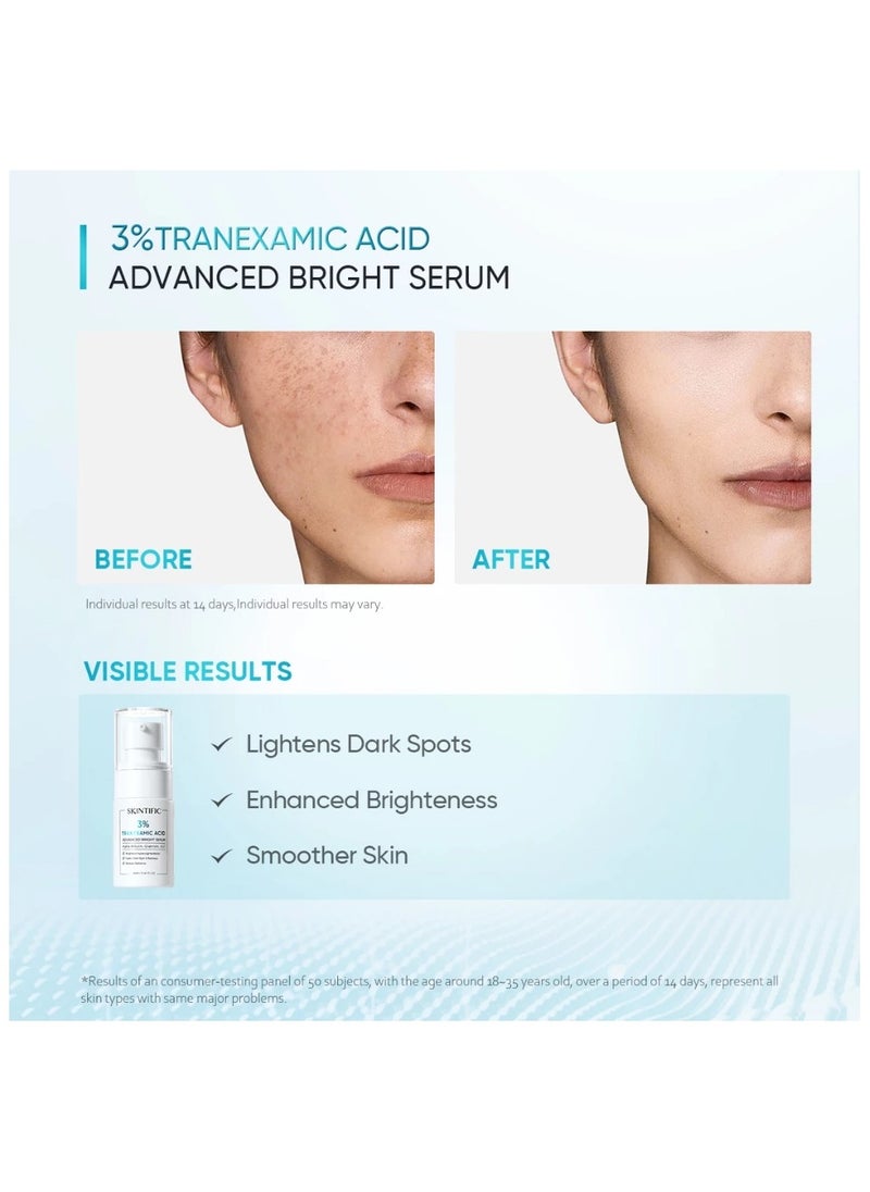 3% Tranexamic Acid Advanced Bright Serum (20ml)