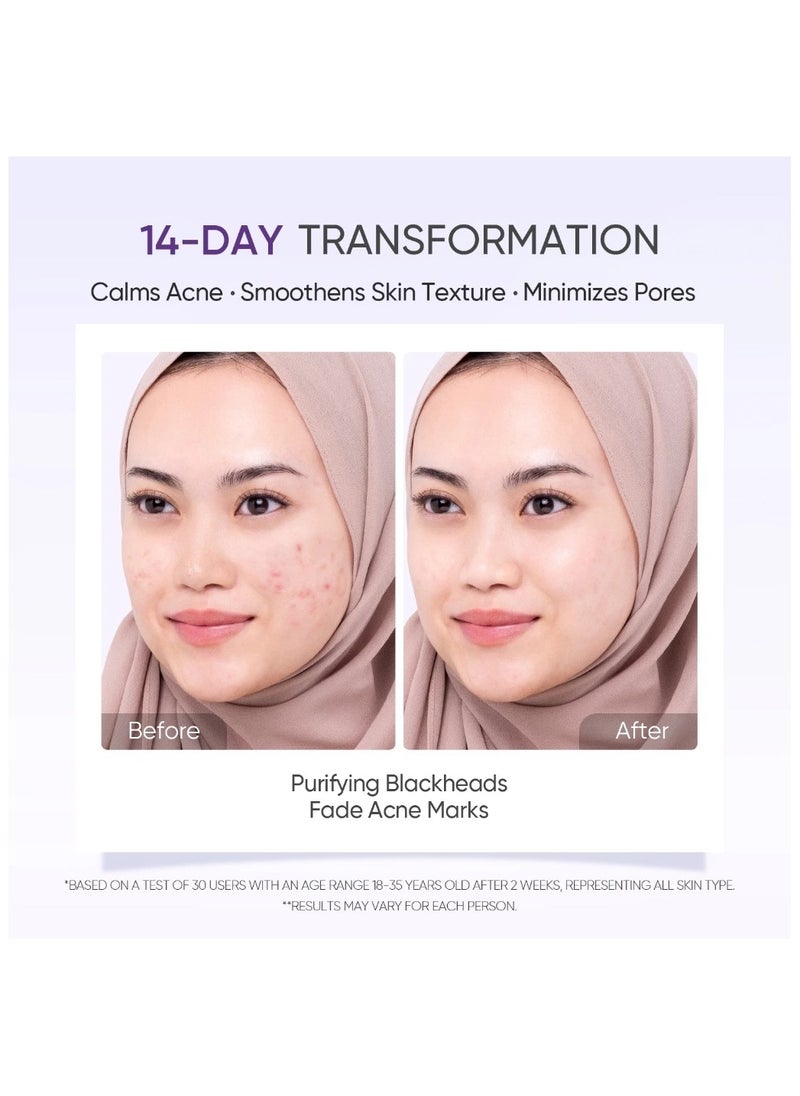 Lactic Acid Skin Renewal Exfoliating Serum Acne Treatment Pore-Tightening 20ml