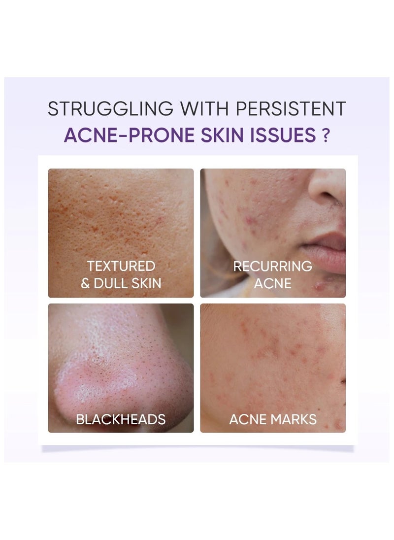 Lactic Acid Skin Renewal Exfoliating Serum Acne Treatment Pore-Tightening 20ml