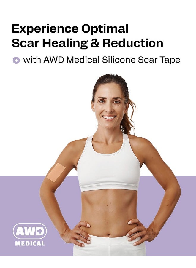 AWD Silicone Scar Sheets for Surgical Scars - Silicone Scar Tape for C Section, Tummy Tuck Tape, Keloid Treatment - Silicone Skin Patches After Surgery Must Haves (1.6