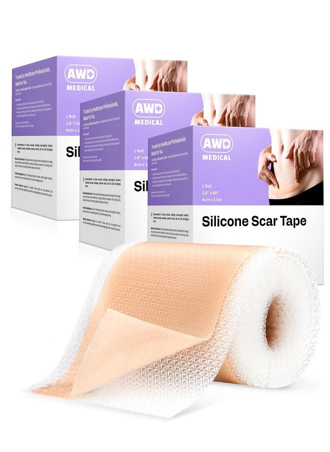 AWD Silicone Scar Sheets for Surgical Scars - Silicone Scar Tape for C Section, Tummy Tuck Tape, Keloid Treatment - Silicone Skin Patches After Surgery Must Haves (1.6