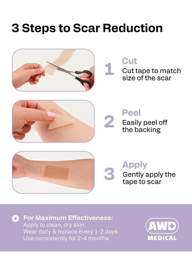 AWD Silicone Scar Sheets for Surgical Scars - Silicone Scar Tape for C Section, Tummy Tuck Tape, Keloid Treatment - Silicone Skin Patches After Surgery Must Haves (1.6