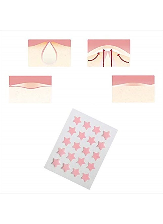 Acne Pimple Patch , Hydrocolloid Absorbing Patch Clear Acne Stickers (4 Sheets/80Patchs)