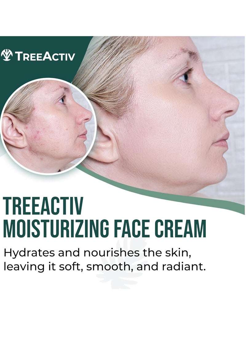 TreeActiv Acne Cream Original Formula, 2 fl oz, 2% Salicylic Acid Face Moisturizer for Oily Skin, Skin Care Acne Formula for Cystic Acne Treatment, Hydrating Face Moisturizer for Acne Prone Skin