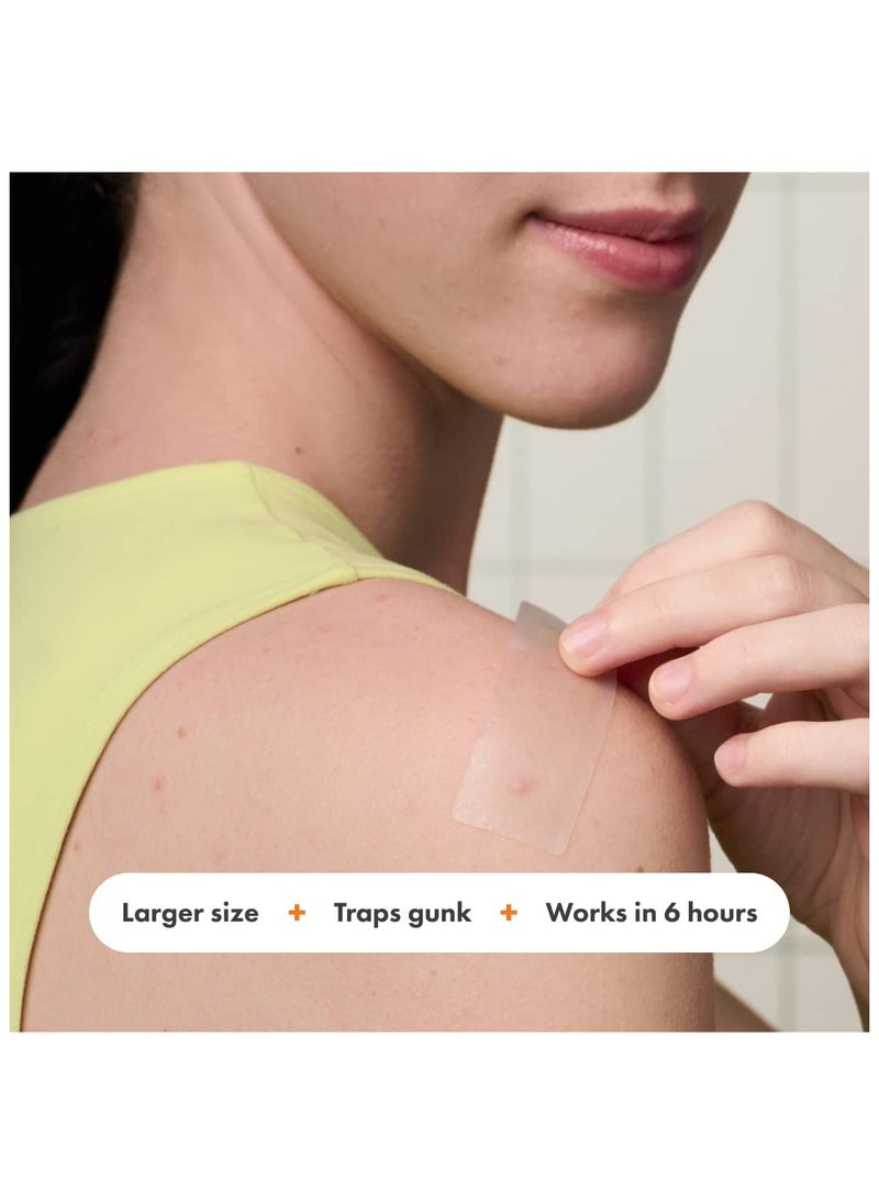 Surface - Hydrocolloid Large Acne Pimple Patch Spot Treatment (10 count) for Body and Larger Breakouts on Cheek, Forehead, Chin, Vegan, Cruelty-Free, 50% Better Absorption