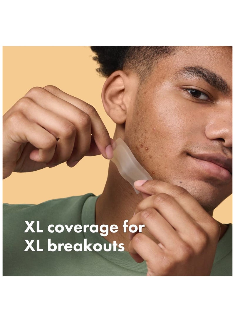 Surface - Hydrocolloid Large Acne Pimple Patch Spot Treatment (10 count) for Body and Larger Breakouts on Cheek, Forehead, Chin, Vegan, Cruelty-Free, 50% Better Absorption