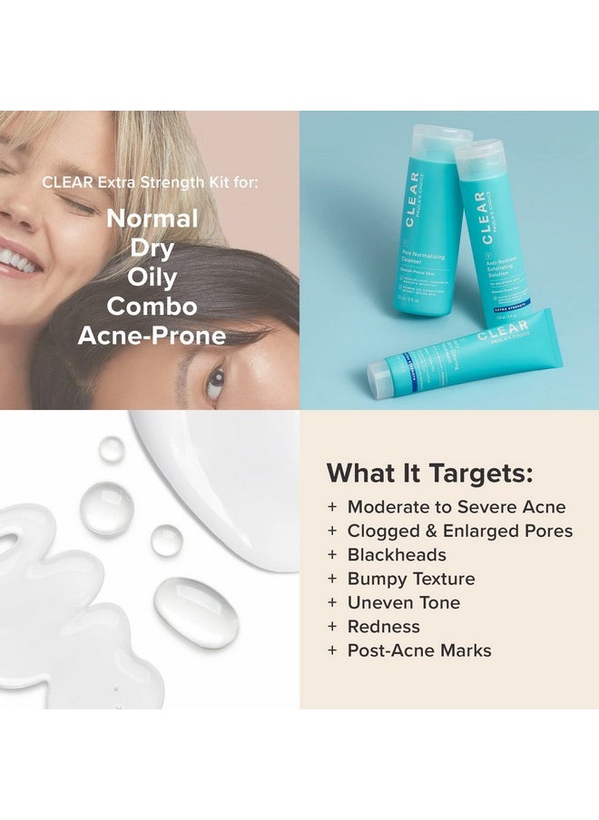 Paula's Choice CLEAR Extra Strength Acne Kit, 2% Salicylic Acid & 5% Benzoyl Peroxide for Severe Acne, Redness Relief, PACKAGING MAY VARY