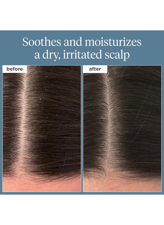 Briogeo Scalp Revival Rosemary Pre-Wash Oil, Hair and Scalp, Dry Scalp Treatment for Stronger and Longer Hair, Soothe Dry Scalp, Lipids and Vitamins, Deep Moisture, Vegan, Cruelty-Free, 3.4 fl oz