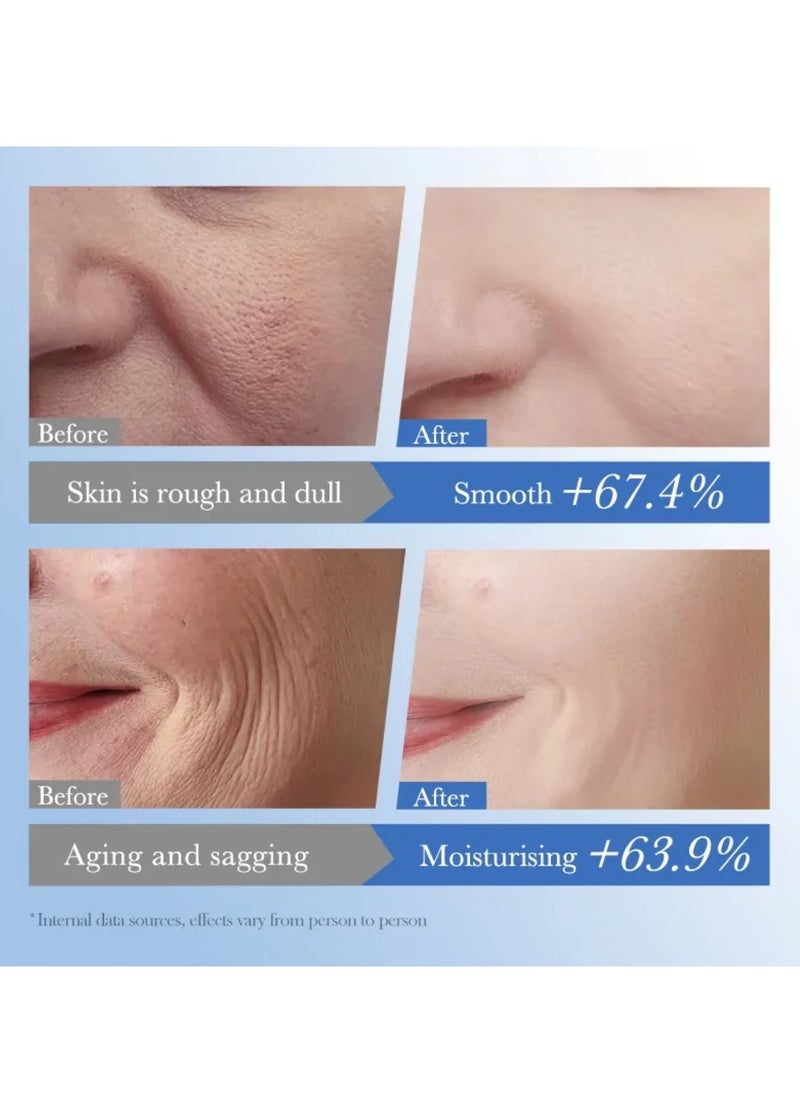 10 Pcs Hyaluronic Acid + Vitamin A Firming Repairing Essence Facial Mask Set  Hydrating Ultra Moisturizing Anti Wrinkle Brightening Soothing Long Lasting Water Locking Skin Care Face Mask Sheet for Women and Men