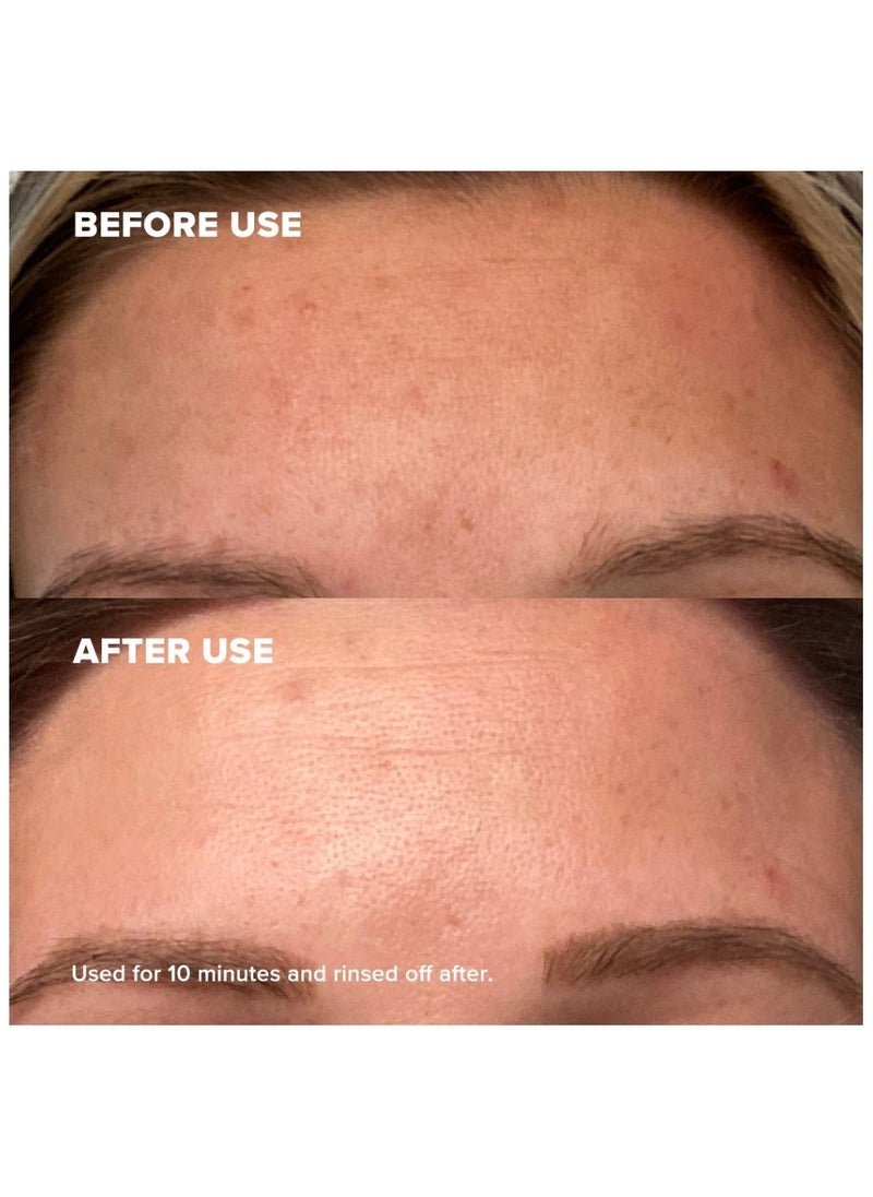 Paula's Choice Skin Perfecting 25% AHA + 2% BHA Exfoliant Peel, Fragrance-Free & Paraben-Free, 30ML