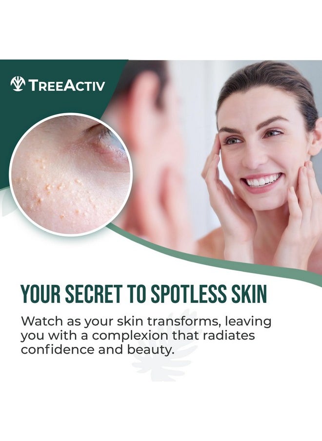 TreeActiv Spot Treatment 0.5oz + Remover Kit Bundle, Includes Spot Treatment and Remover Tool, Bentonite Clay, Tea Tree Oil, Aloe Vera, Clearer Skin in 2 Weeks