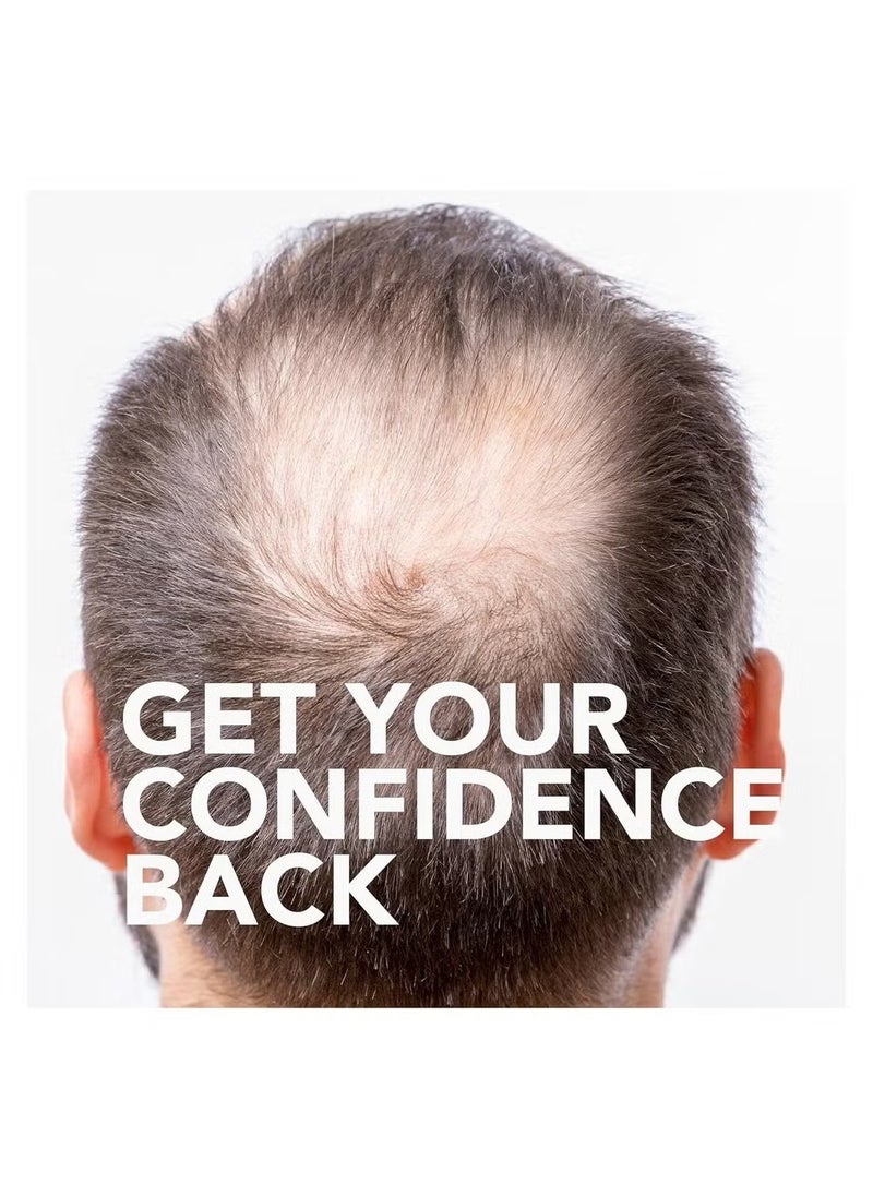 6-Piece Minoxidil Hair Regrowth Treatment