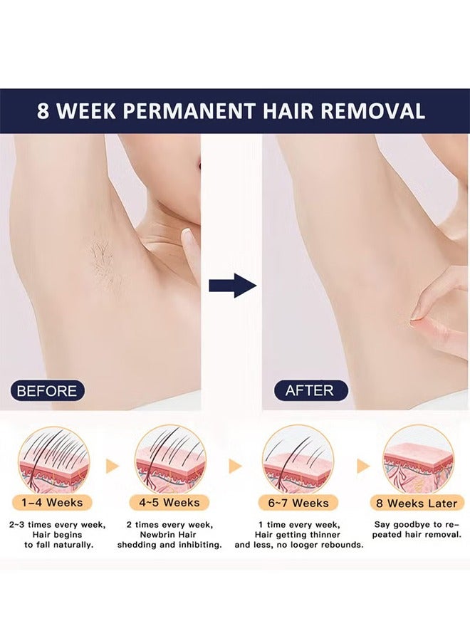T14 Painless Ice Compress Laser Hair Removal Device,500,000 Flashes Epilator For Whole Body Bikini Line Arm Armpit Face Back Leg (1*HR Lamp) Dark Blue