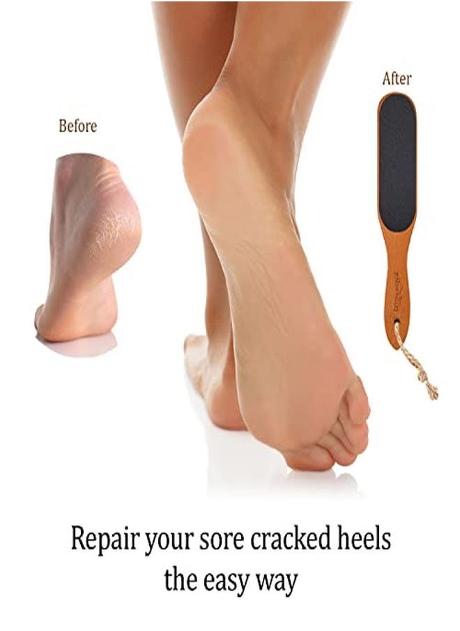 Pumice Stone Foot File Wooden Pedicure Feet Scrubber With Handle For Callus, Dry, And Dead Skin Removal Heel Scraper For Feet, Hands, And Body Exfoliation Perfect Foot Filer For Use In Shower