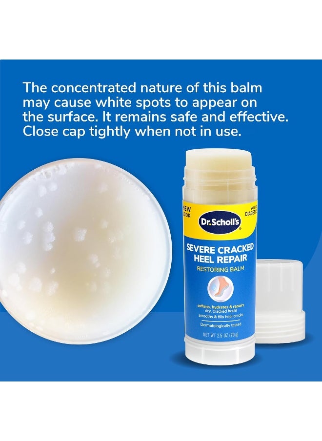 Severe Cracked Heel Repair Restoring Balm 2.5Oz
