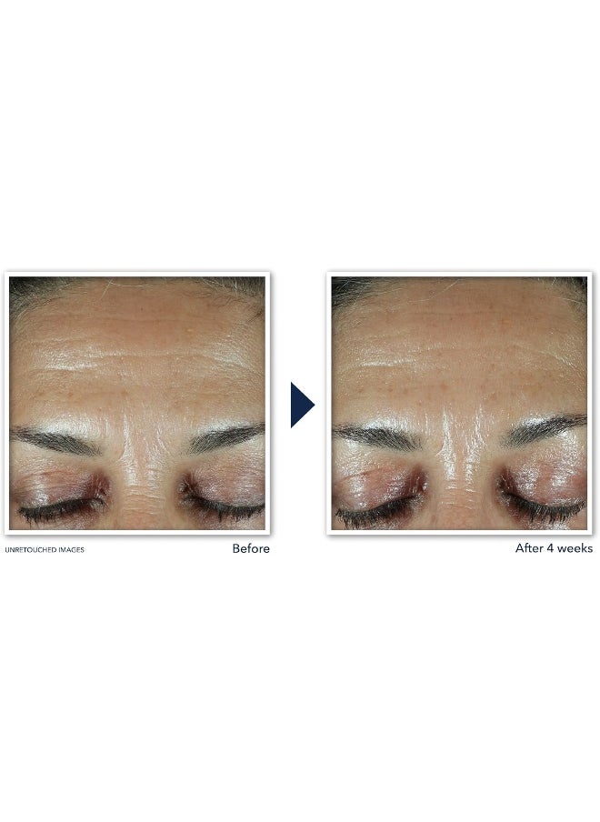 Retinol Correxion Deep Wrinkle Facial Filler With Hyaluronic Acid And Retinol 1 Oz
