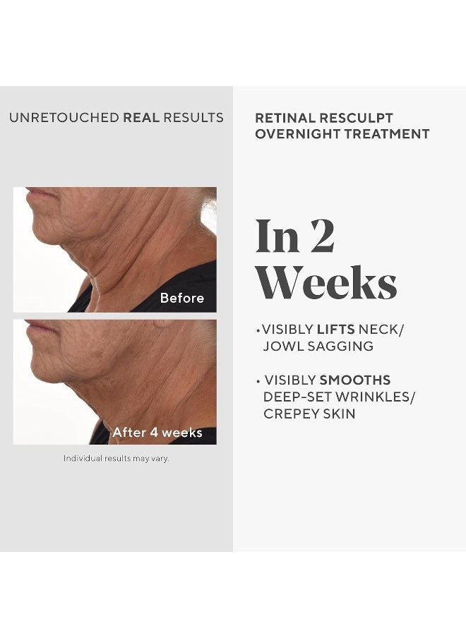 Retinal Resculpt Overnight Treatment - Resurgence Anti-Aging Serum For Lines And Wrinkles