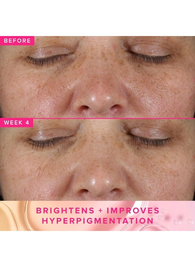 3% Txa Toner For Face - Brightening Face Toner For Oily Skin - Liquid Exfoliant With Azelaic Acid + 5% Pha To Target Visible Dullness + Help Reduce Uneven Skin Tone (50Ml)