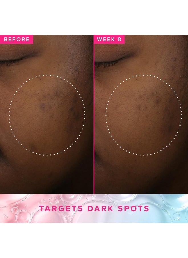 3% Txa Toner For Face - Brightening Face Toner For Oily Skin - Liquid Exfoliant With Azelaic Acid + 5% Pha To Target Visible Dullness + Help Reduce Uneven Skin Tone (50Ml)
