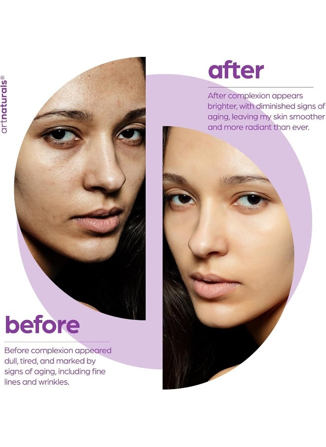 ArtNaturals Retinol Serum for Face - with Vitamin C, 2.5% Retinol Oil & Hyaluronic-Acid - Skin Clearing - Anti-Aging, Anti-Wrinkle Eye Serum - Skin Repair, Night Therapy (1 Fl Oz / 30ml) (ANGA-0127)