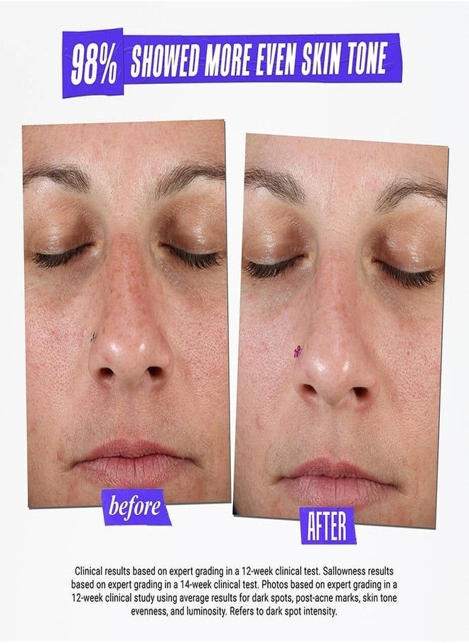 Kiehl's Clearly Corrective Dark Spot Solution – Brightening & Even-Tone Serum with Activated C, White Birch, & Peony Extract, Reduces Dark Spots & Hyperpigmentation, 15ml (0.5oz)