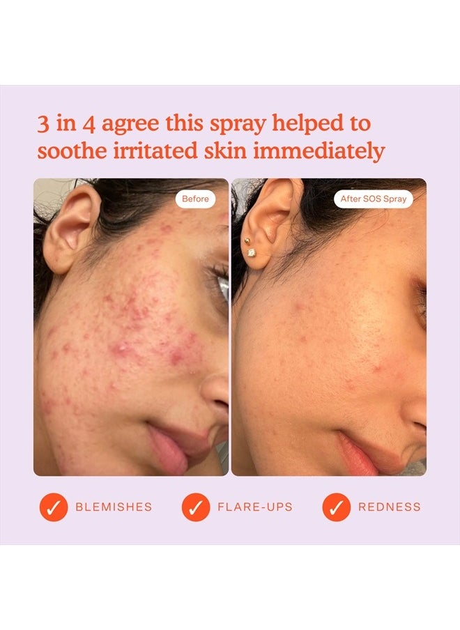 SOS Daily Rescue Facial Spray for Sensitive Skin, Hypochlorous Acid Spray Helps Reduce Redness and Breakouts, Full Size Toner for Face, 4 FL Oz