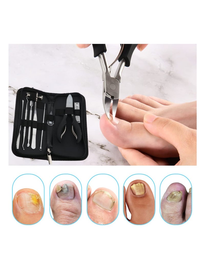 Ingrown Toenail Tools Kit 10 Pieces - White