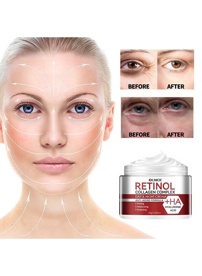 Retinol Collagen Complex 30g, Anti Aging Cream With Hyaluronic Acid And Collagen, Wrinkle Removal Skin Firming Cream, Retinol Moisturizer Cream For Skin Tightening, Dry Lines And Fine Lines