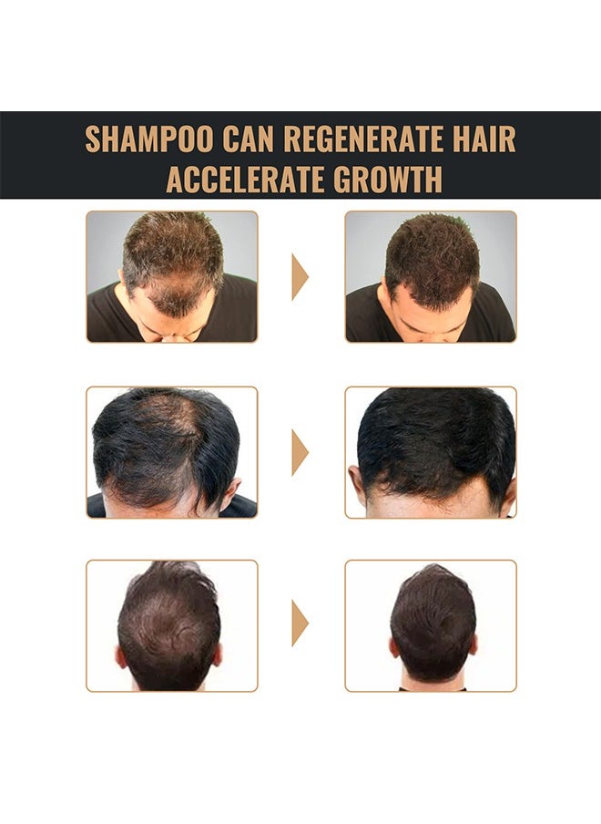 Root Activating Shampoo 100ml, Strengthen Hair Root Anti Falling and Firm Hair, Thick and Fluffy Hair, Soft and Strong Hair Repair and Care Shampoo