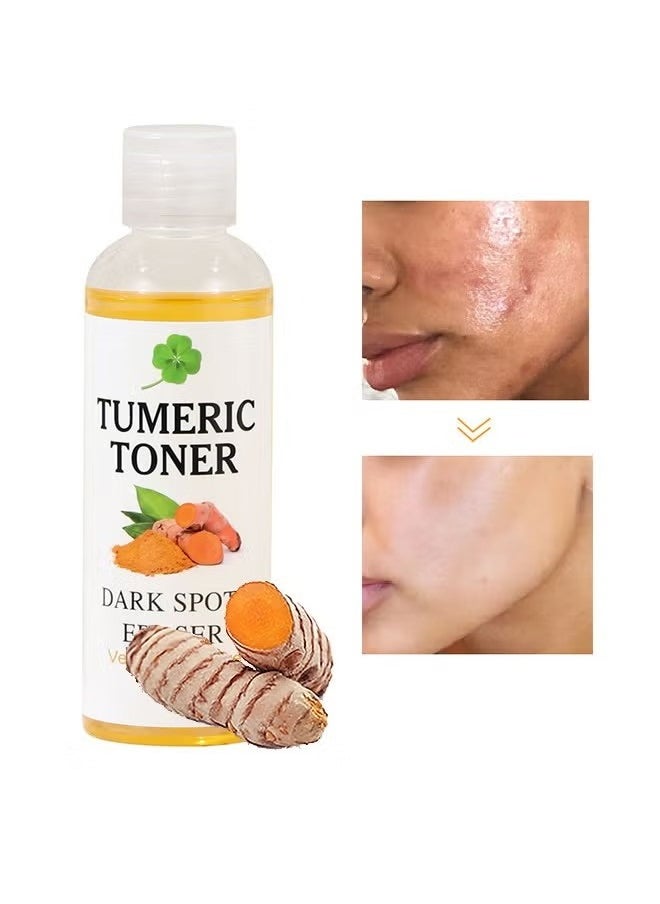 Turmeric Dark Spot Corrector Toner 100ML Facial Toner For Acne Prone Skin Dark Spot Remover For Face Hydrating Face Toner For Women Treatment 100ml