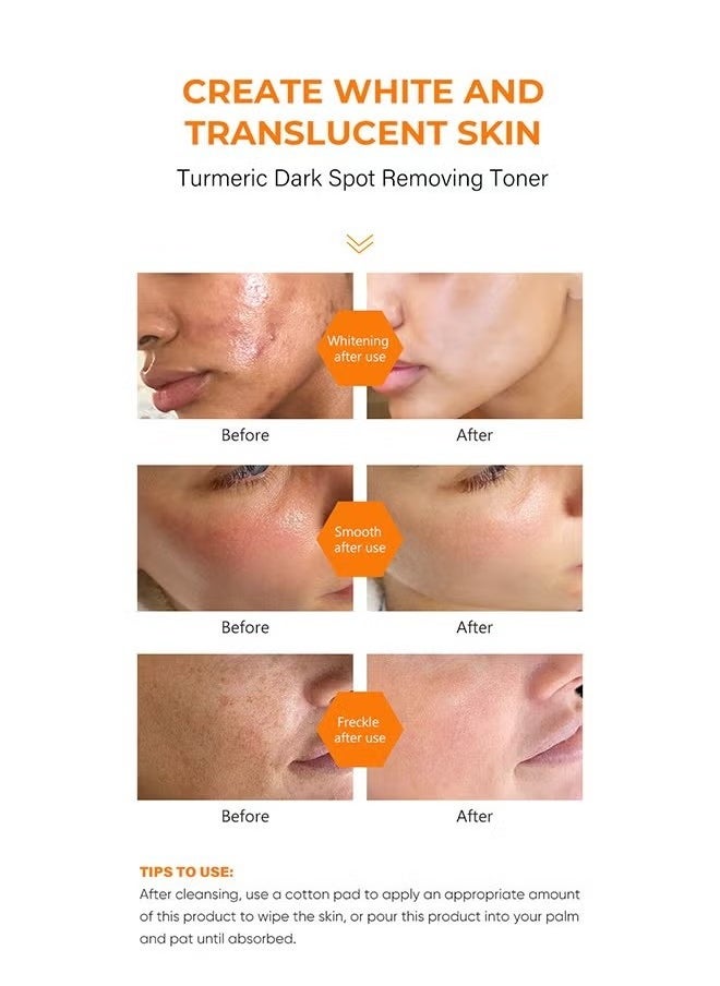 Turmeric Dark Spot Corrector Toner 100ML Facial Toner For Acne Prone Skin Dark Spot Remover For Face Hydrating Face Toner For Women Treatment 100ml