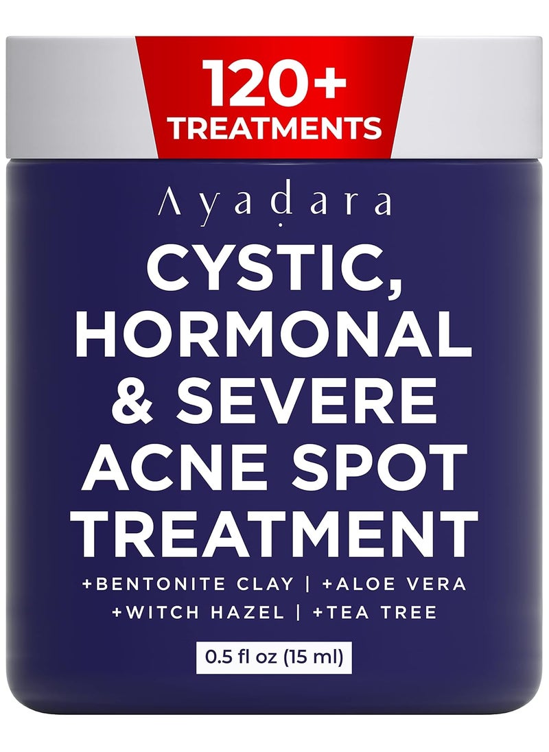 Cystic Acne Spot Treatment Overnight Hormonal Cystic Acne Treatment for Face Women Men and Teens Cystic Hormonal Acne Treatment for Body Pimple Cream Sulfur Acne Spot Treatment 120 Uses