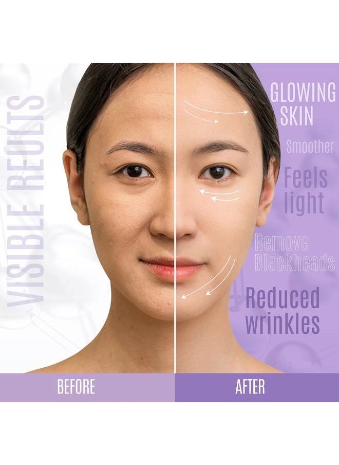 Dermaxgen Lift And Firm - 30% Peptide Serum, Matrixyl 3000, Vitamin C & E + Hyaluronic Acid + Aloe Vera, Lifts, Firms & Tightens Skin + Pure Organic Anti-aging Serum (1 FL OZ)