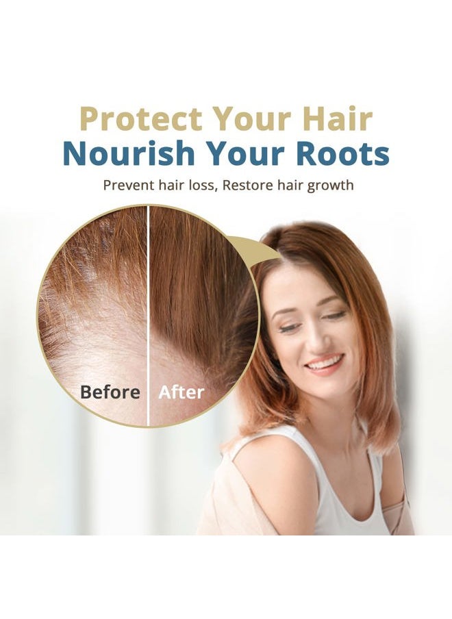 ® Topical Saw Palmetto and Pumpkin Seed Oil Extract for Hair Loss, Strengthens Hair Roots, Soothes Dry Scalp, with Rosemary, Castor Oil, and Lavender Scent, 4oz Bottle