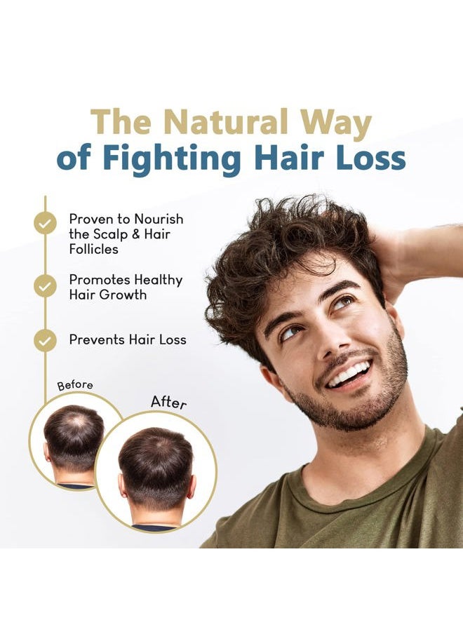 ® Topical Saw Palmetto and Pumpkin Seed Oil Extract for Hair Loss, Strengthens Hair Roots, Soothes Dry Scalp, with Rosemary, Castor Oil, and Lavender Scent, 4oz Bottle