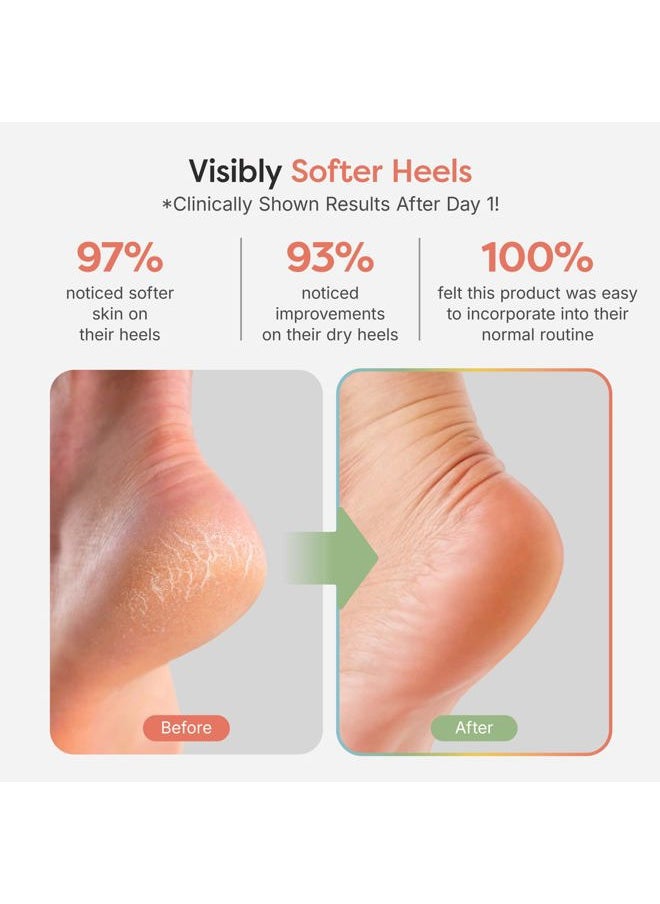 Moisturizing Socks for Cracked Heel Treatment - Vitamin E, Olive Oil and Jojoba Oil Infused to Soften and Hydrate - Heel Socks for Dry Cracked Feet Women (Fuzzy Black, Wide Width)