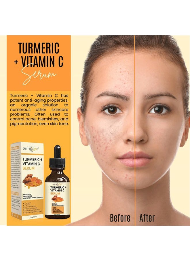 Turmeric Face Serum + Vitamin C: Organic Moisturizer for Acne Reduction, Clear Skin Tone, & Anti-Aging Benefits - Hydrate Dull & Dry Skin - Facial Serum - 2 FL OZ