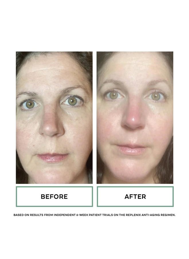 Anti-Aging Retinol + Bakuchiol Concentrated Face Serum, Medical-Grade Facial Treatment for Mature, Uneven Skin (1 fl. oz)