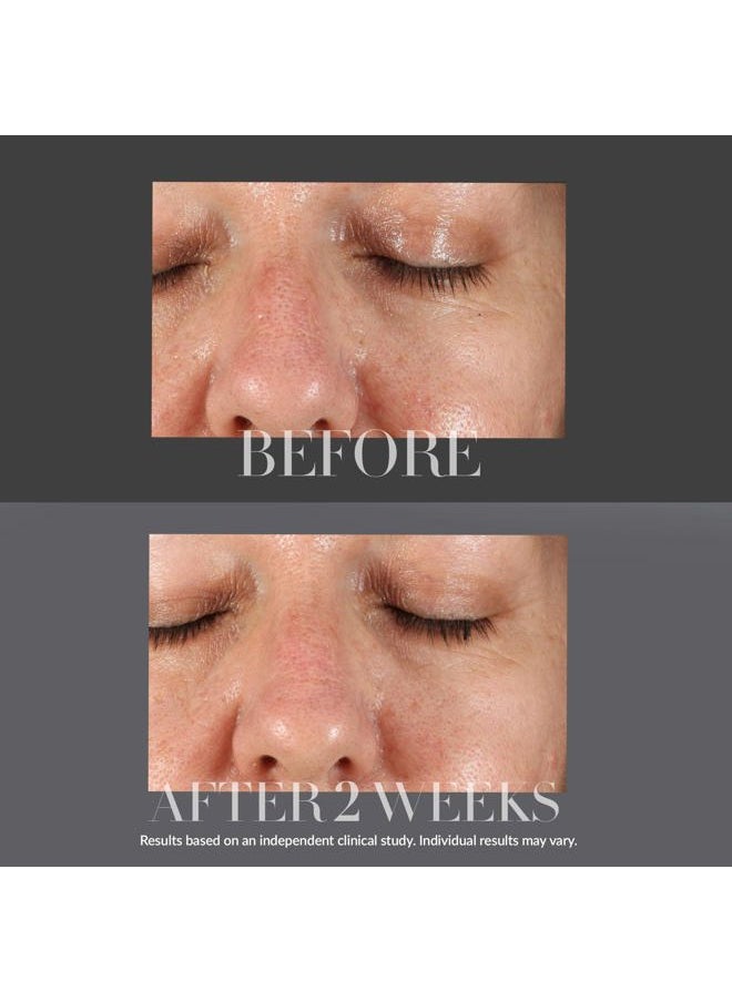 KateCeuticals Resurfacing Overnight Peel | Clinic-Grade Face Peel | Powerful Anti-Aging Treatment | 1 Fl Oz