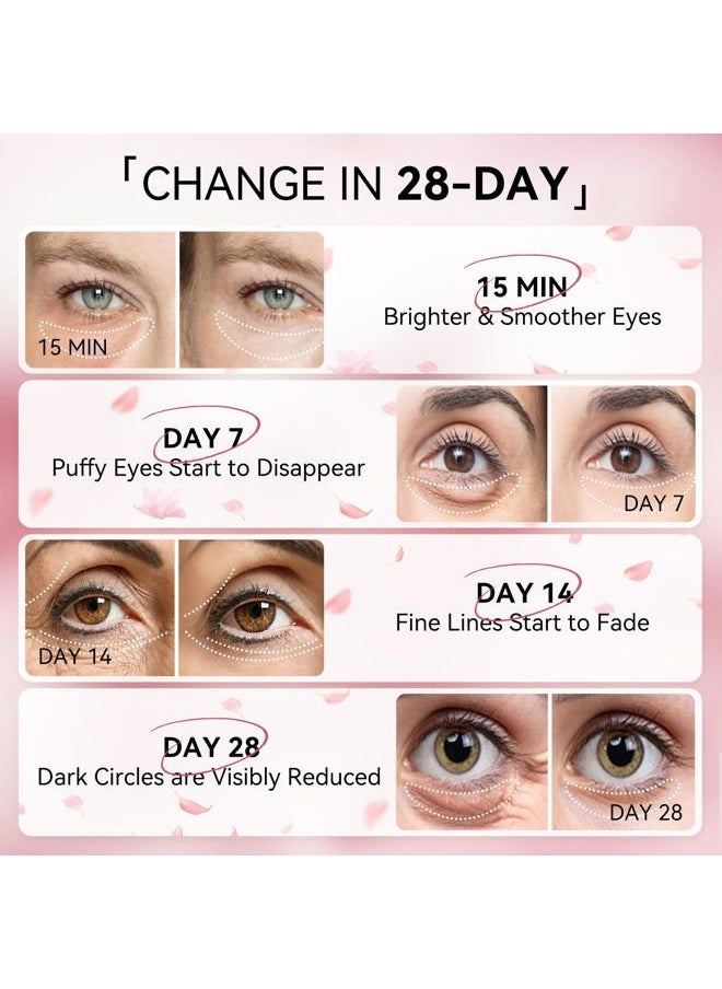Pink Rose Eye Mask– 60 Pcs - Puffy Eyes and Dark Circles Treatments – Look Younger and Reduce Wrinkles and Fine Lines Undereye, Improve and Firm eye Skin - Pure Natural Material Extraction