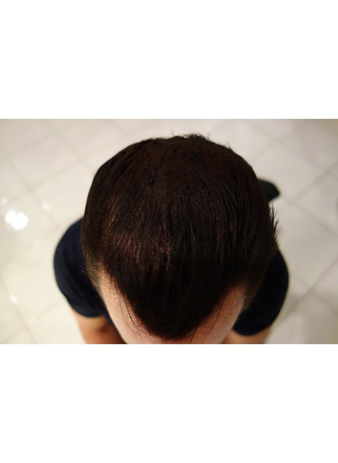 Hair Fiber Refill 100 Grams For Hair Loss Concealing by Finally Hair (White)